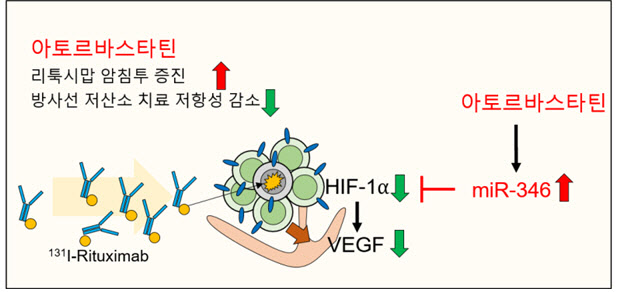 고지혈증 치료제가 림프종 치료 돕는 기전 밝혀져