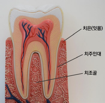 '잇몸이 붓고 양치할 때 피가 나요' 잇몸이 보내는 구조 신호