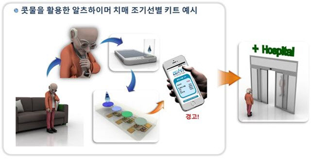 콧물 검사로 알츠하이머성 치매 조기에 진단한다