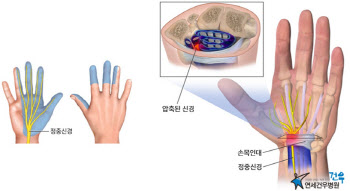 외출도 안 했는데 왜 몸 상태가...코로나19가 몰고온 VDT증후군