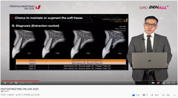 치과 코로나 불황 속 홀로 펄펄나는 오스템임플란트