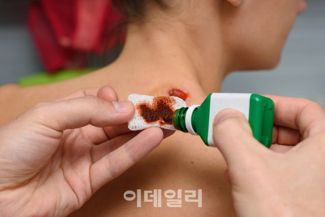 “빨간약은 만병통치약?”…코로나19 바이러스 99.99% 사멸