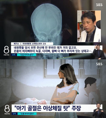 생후 3개월 딸 온몸 골절상 입힌 친모 “뼈 잘 부러지는 체질”