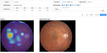 강북삼성병원, 안과 질환 자동 진단…딥러닝 알고리즘 개발
