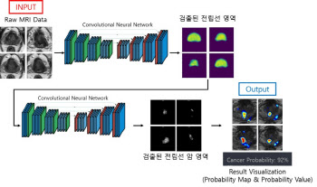 제이엘케이, 전립선암 영상SW 식약처 허가 획득