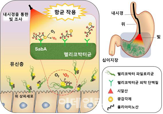 가톨릭대, 빛 쬐어 헬리코박터균 없애는 치료법 개발