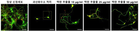 '안면신경마비'에 '한약'의 신경치료 효과 입증