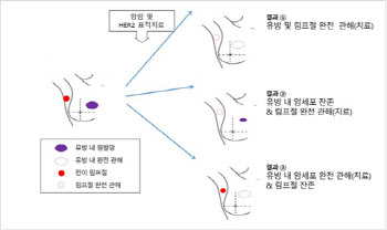 HER2 양성 유방암 표적치료, 림프절 전이암도 사라진다