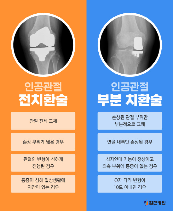 내 관절 보존하고 닳은 관절만 바꿔주는 인공관절 부분치환술