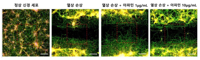 봉침 속 '아파민' 성분 신경세포 재생 효과 입증