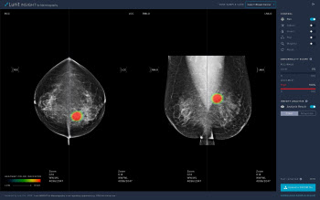 루닛 AI 유방암 검출 솔루션, 미국 FDA 허가 ‘국내 최초’