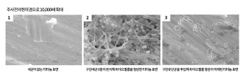 오라팜 구강유산균, 임플란트 주위점막염을 예방에 도움