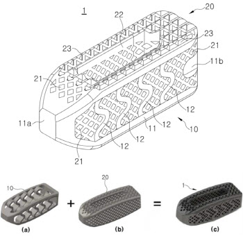 솔고바이오, 3D 프린팅 척추 수술용 케이지 한·미 특허 취득