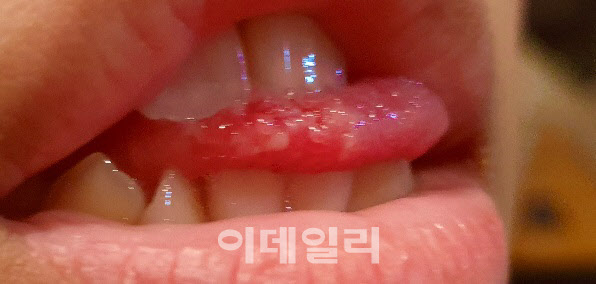 "유명 호텔 생수병서 락스가..죽을 뻔했습니다"