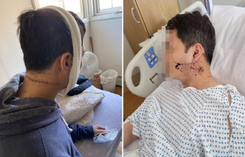 "아무 이유도 없었다, 그저 아시아로 돌아가라며 커터칼을…"