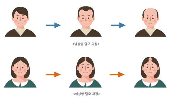 예방적 탈모 약 복용, 몸에 큰 부작용 없다