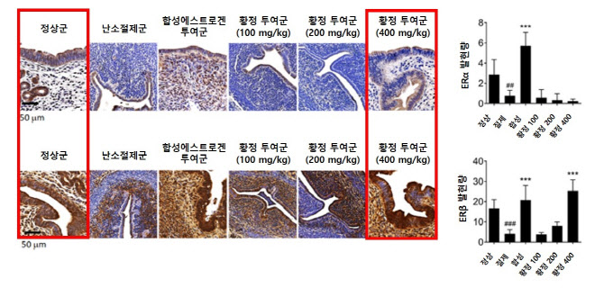 갱년기 치료, "부작용 적은 천연 한약재에서 답을 찾는다"