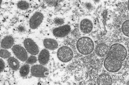 필리핀, 원숭이두창 감염 2건 추가…누적 확진자 3명