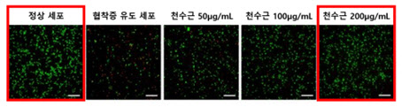 자생한방병원, 청파전의 척추관협착증 치료 기전 입증