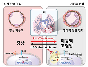 폐동맥 고혈압 위험 높이는 유전자 경로 찾았다