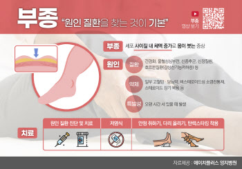 신발 작아지고 반지 꽉 낀다면? ... 부종의심해봐야