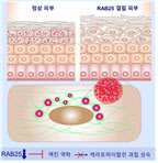 아토피 피부염 약물 개발 실마리 제시