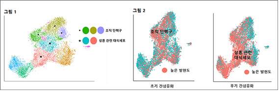 간섬유화 진행 단계별 발병기전 규명