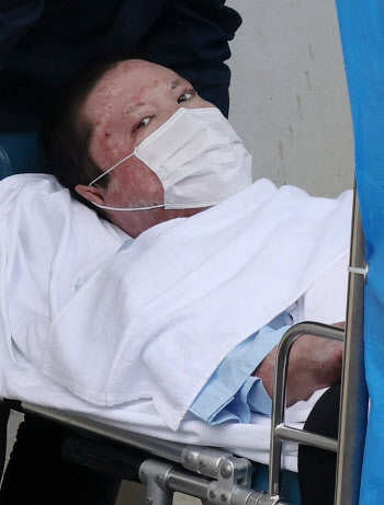 “예측 사망률 97.45%” 치료받고 산 쿄애니 방화범...日검찰 ‘사형’ 구형