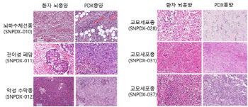 환자유래 이종이식 모델 활용해 뇌종양 연구의 새로운 지평 열어