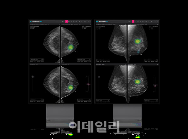 루닛, 3D 유방암 검진 ‘루닛 인사이트 DBT’ 미국 내 첫 판매
