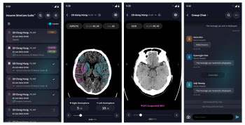 휴런, 뇌졸중 선별 AI 모바일앱 내놨다