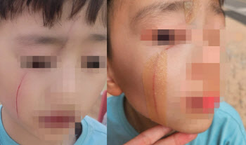 “초2 아들 얼굴, 연필로 그어놨다…학교 폭력 성립되나요”