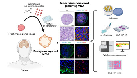 뇌수막종 환자 세포 유래 오가노이드, 국내 첫 개발