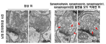 뇌 속 신경전달물질 주머니 크기 조절인자 최초 발견