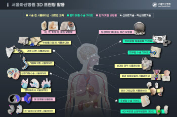 서울아산병원 3D프린팅 도입 10년…진료·연구·교육의 新 패러다임