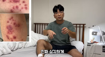 “7000원 발마사지 받고 수술…동남아 ‘이것’ 조심하라” 유튜버의 경고