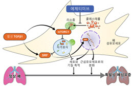 특발성 폐섬유증, 콜레스테롤 약제 치료 효과 확인