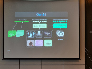 구글 "메드-제미나이가 분석한 '흉부CT', 의사 3분의 2는 우수 평가"