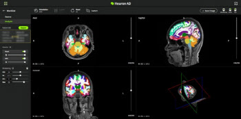 휴런, 대만 진출 초읽기...알츠하이머 예측 AI 대만 FDA 승인
