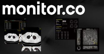 의료AI 기업 '모니터코퍼레이션', 70억 시리즈B 투자 유치