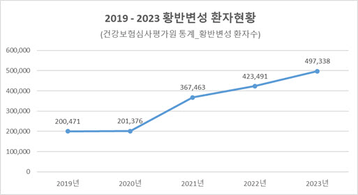 소리없이 실명하는 '황반변성... 5년사이 2.5배 증가해 조심