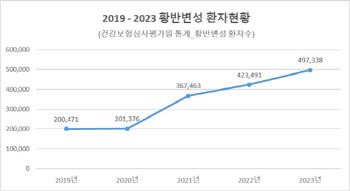 소리없이 실명하는 '황반변성... 5년사이 2.5배 증가해 조심