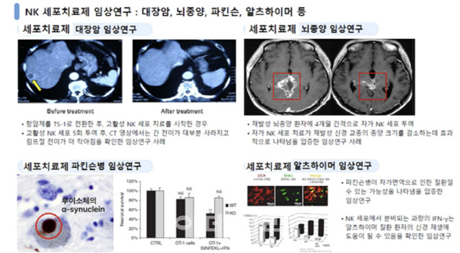 ‘세포치료제 무상 시술’ 前 충북경제자유구역청장 재판行