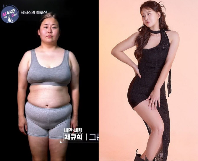 맥미걸 '위기의 아내' 지방흡입+30kg 감량...깜짝 근황 화제
