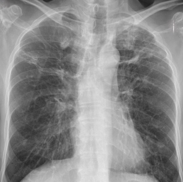 의협 ‘한의사, X-ray 판결 왜곡 해석’ 반박