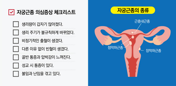 가임기 여성 3명 중 한 명이 겪는 ‘자궁근종’, 방치하지 말아야