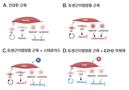 EZH2 억제제로 듀센근이영양증 근육섬유화 감소. 근력향상 효과 입증