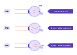 "난이도 높은 ‘원시’도 해결 가능하다"