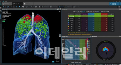 [단독]코어라인소프트 CFO "美 라드넷과 지분투자 등 협력 논의...파트너십 확장"