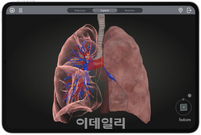 휴톰, 폐암 수술 특화 ‘RUS LUNG’ 출시…"흉부외과 시장 진출"
